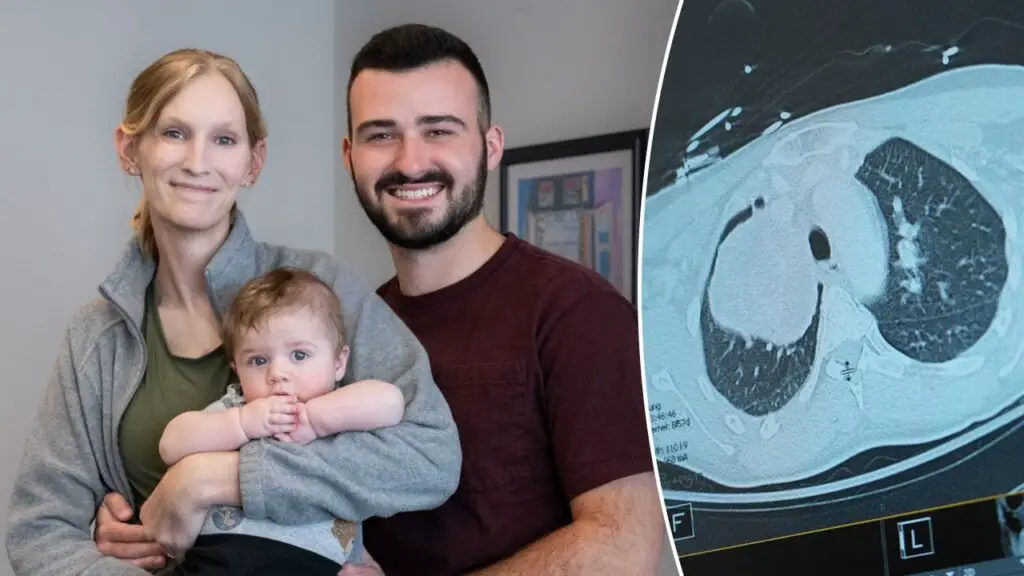 Pregnant woman and baby saved after doctors discover tumor the size of a grapefruit