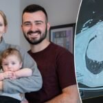 Pregnant woman and baby saved after doctors discover tumor the size of a grapefruit